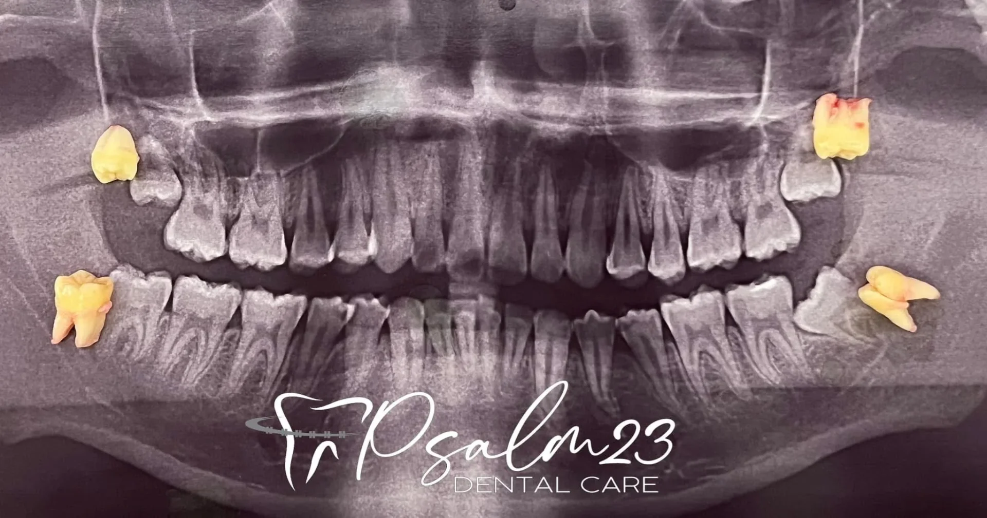 Psalm23 Dental Care oral surgery services — photo 1